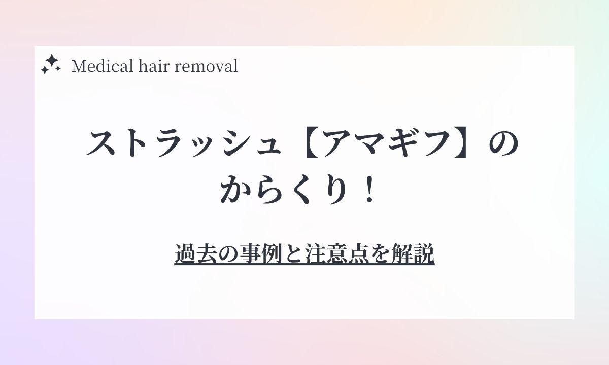 ストラッシュのアマギフからくりとは？